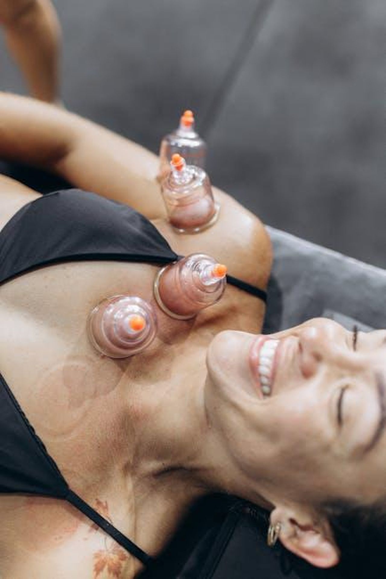 Source: Jonathan Borba - pexels - A woman enjoying a relaxing cupping therapy session for health and wellness.